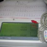 burdick e550 interpretive ekg new and used machines for sale the machine market 56272